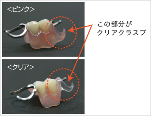 八王子市大和田町の歯医者、はら歯科医院の入れ歯治療